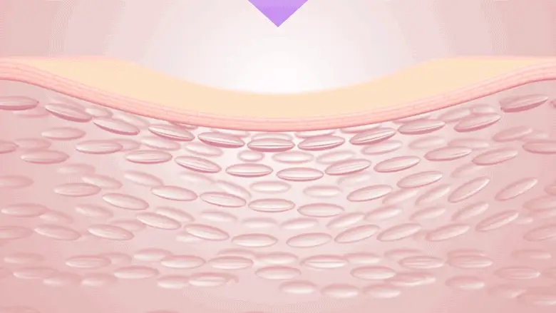Thumbnail 21
