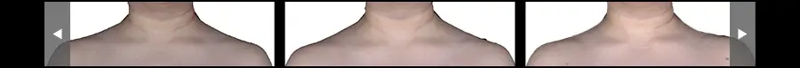 Thumbnail 57