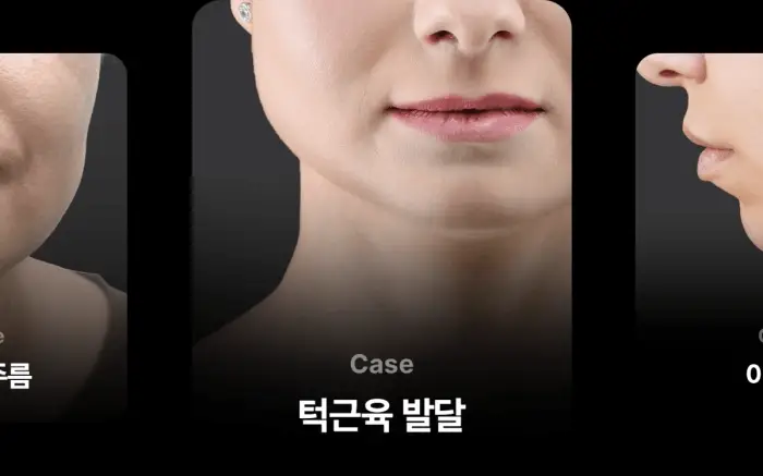 Thumbnail 22